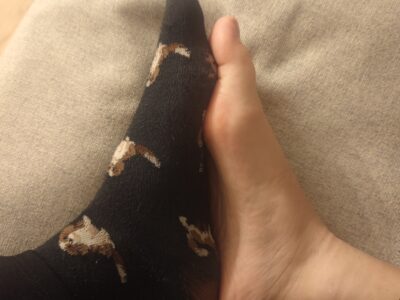 Socken ausziehen? :)