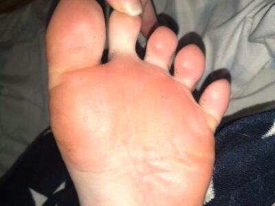 Toe play