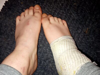 Fußbilder mit Ferband