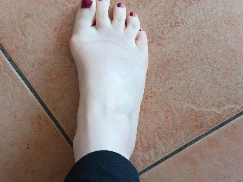 🦶🏼